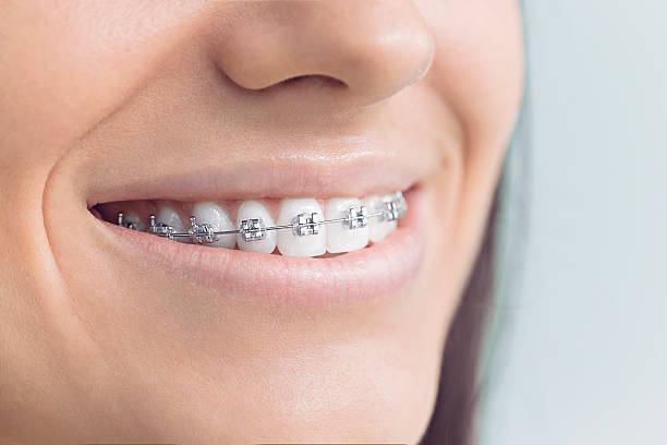 Best Invisalign and Clear Aligners  in Edgewood, WA